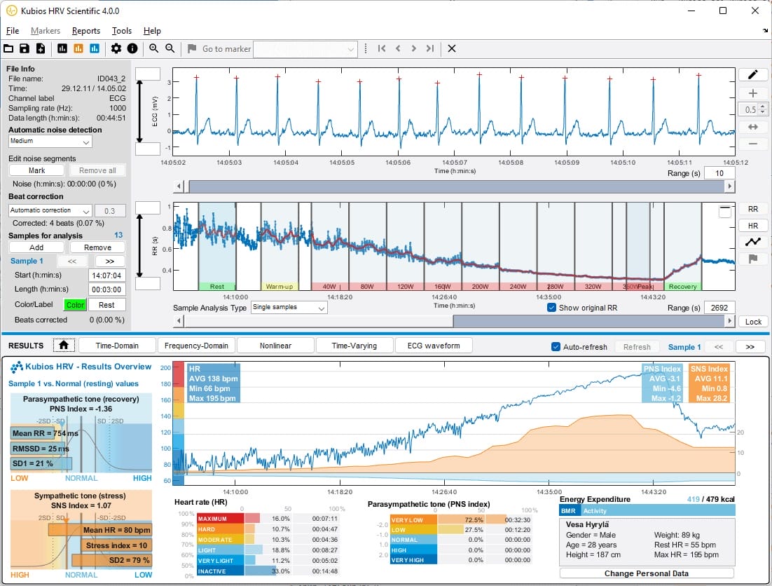 Screenshot of Kubios HRV Scientific software showing comprehensive HRV analysis with detailed graphs and metrics on heart rate, parasympathetic nervous system index, and energy expenditure.