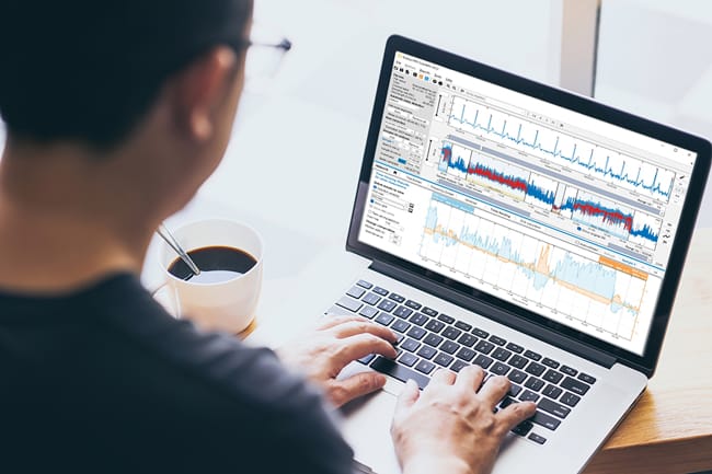 A person uses a laptop displaying a detailed SENS Motion graphical analysis, with various charts and graphs, while holding a cup of coffee.