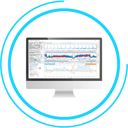 A computer monitor displays data graphs and charts, including line graphs in blue and orange, integrated with SENS Motion's analytical software interface elements.