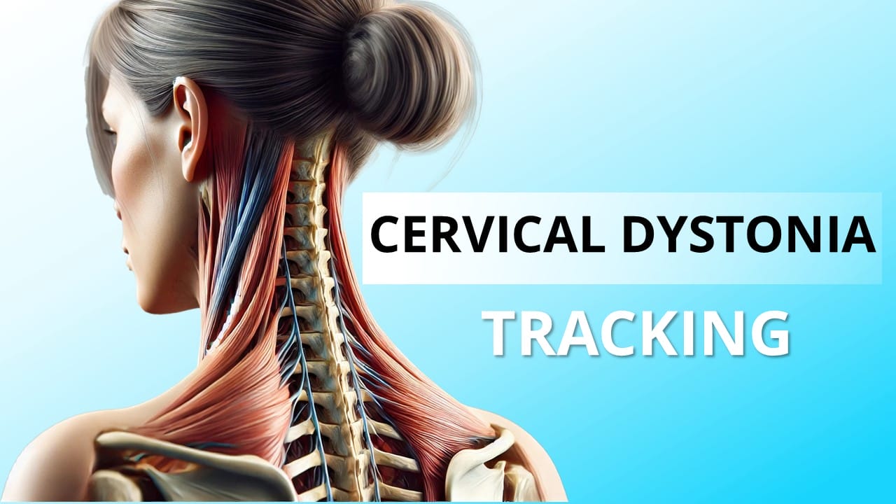 Image of a woman with highlighted neck muscles and spine, illustrating cervical dystonia progression and severity tracking. A gradient of light blue forms the background, emphasizing the potential for wearable motion sensors to monitor changes.